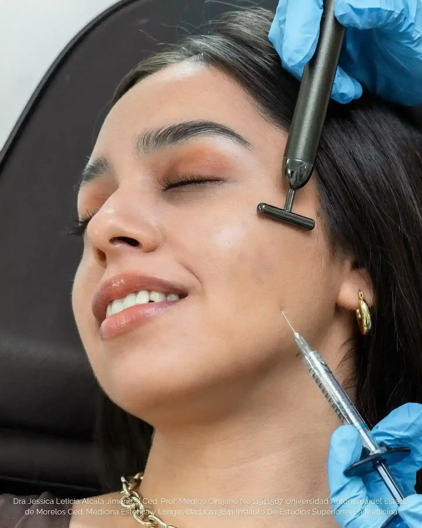 Aplicación de tratamiento facial