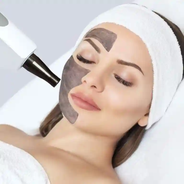Hollywood Peel
